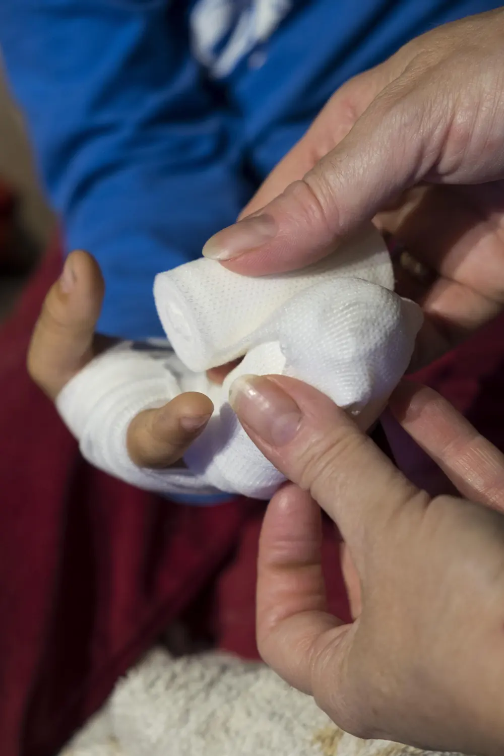 Main bandée après une blessure du quotidien